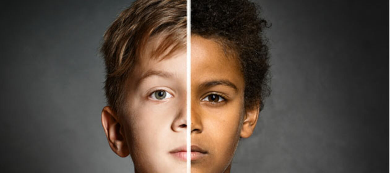 Ein geteiltes Gesicht: links ein weißer, rechts ein farbiger Junge