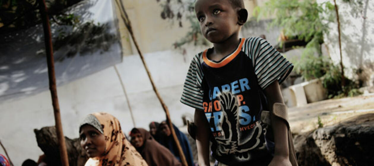 Der achtjährige Liban aus Somalia hat durch eine Bombenexplosion sein Bein verloren.