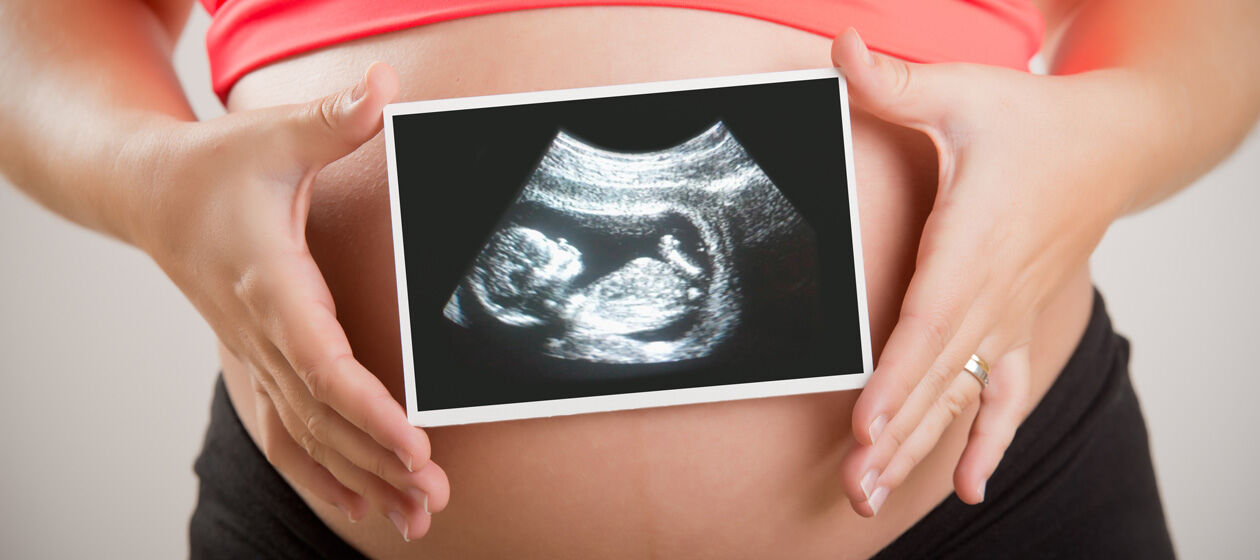 Frau hält Ultraschallbild vor Babybauch 
